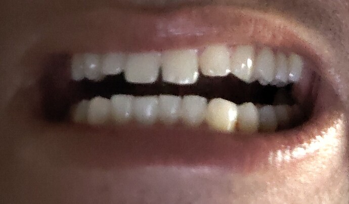 1000003241