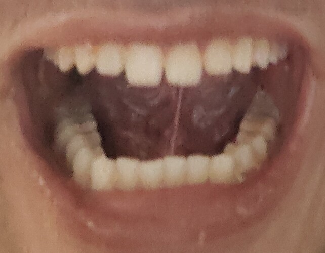 1000002591