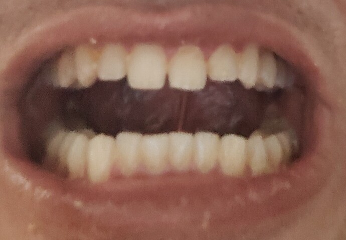 1000002592