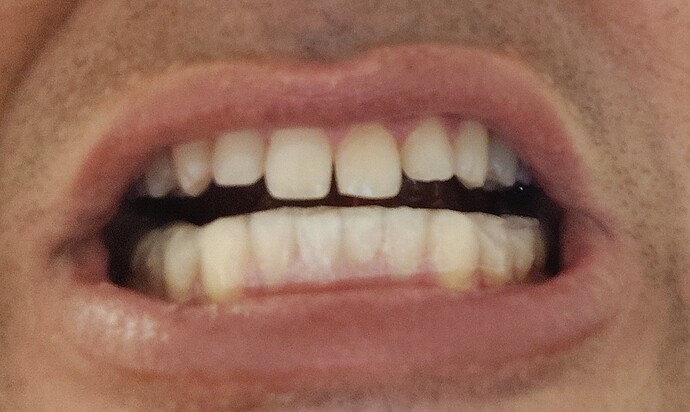 1000003265