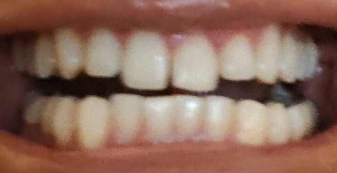 1000003300