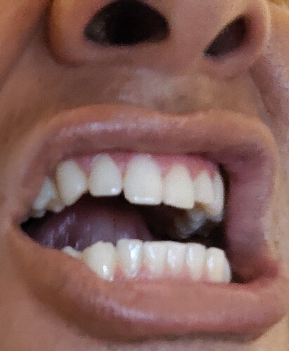 1000003303