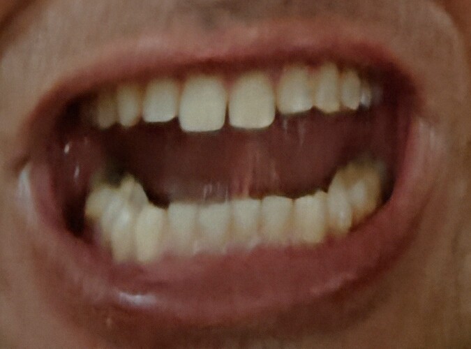 1000003598