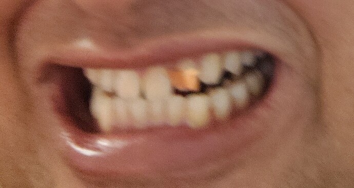1000003260