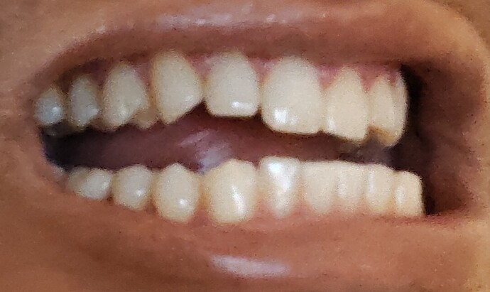 1000003302