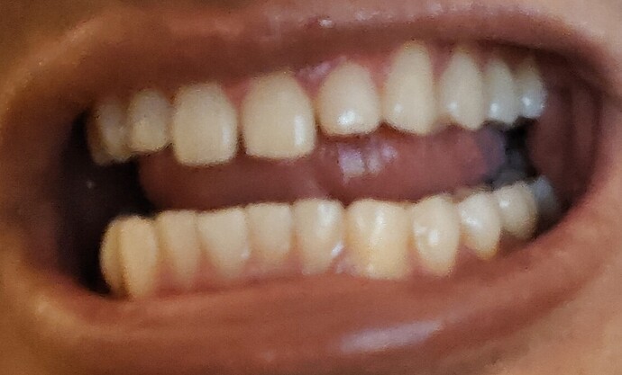 1000003301