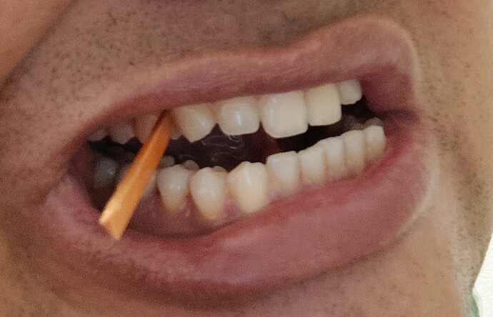 1000003256