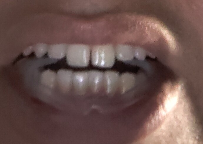1000003326