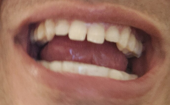 1000003267