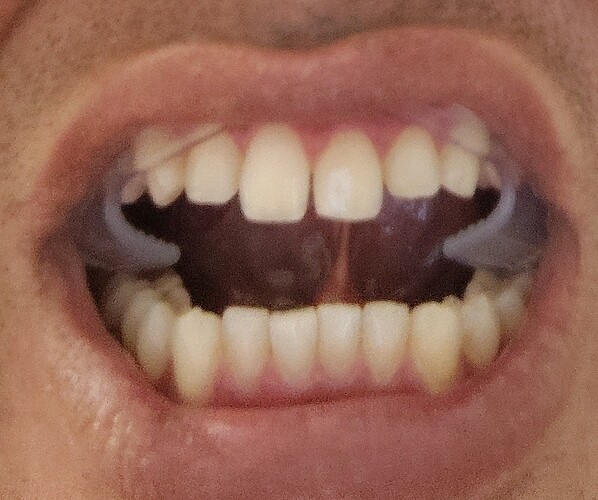 1000003325