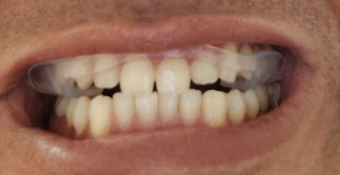 1000003324