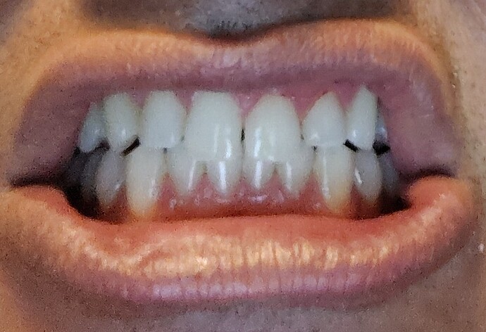 1000003365